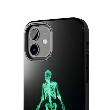 Introducing our "Radiant Bones" -Tough Cell Phone Cases